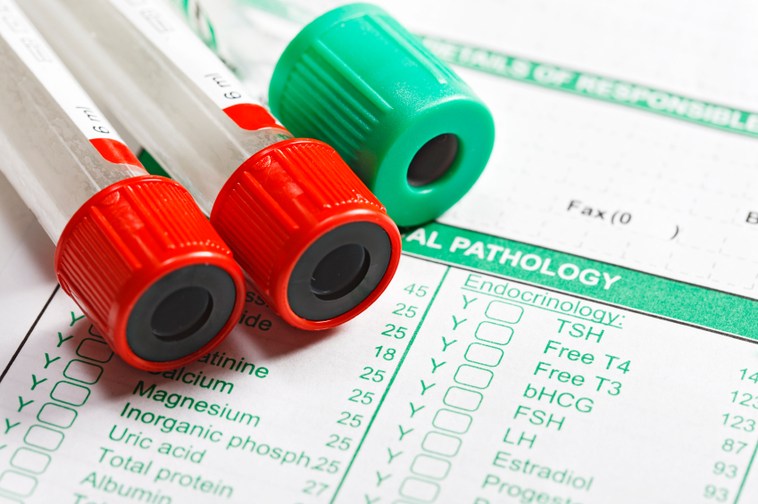 Vitamin D test krvi
